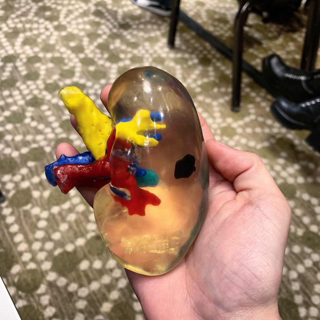 a 3D-printed kidney from axiel3d labs
